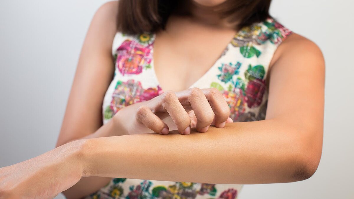 Frau in Sommerkleid kratzt sich am Arm